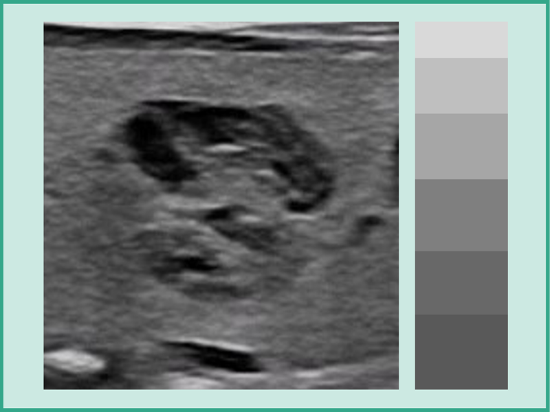 Image with the “DeepInsight Technology” applied.