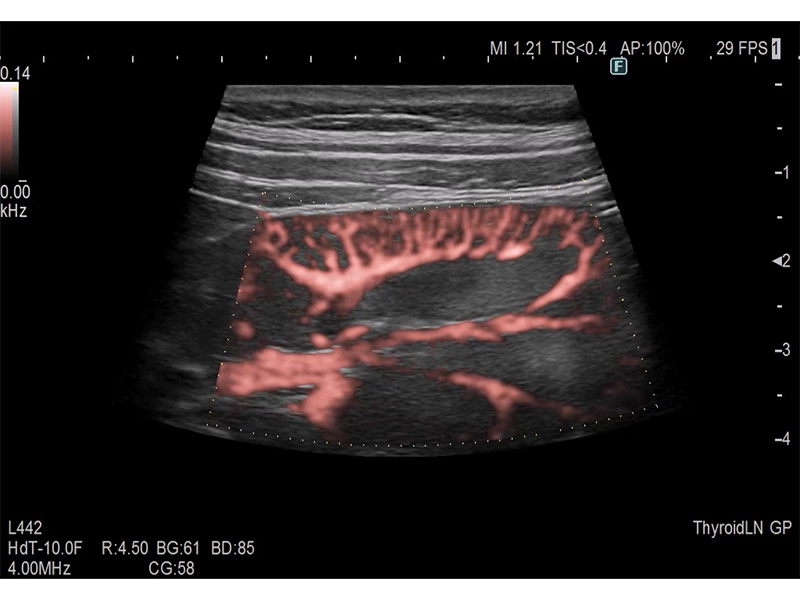 Detective Flow Imaging (DFI)​