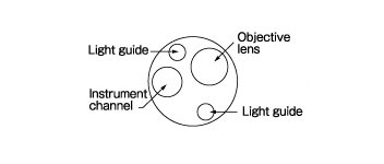 [image] Tip of scope with parts - light guides, objective lens, instrument channel
