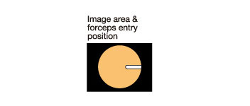 [image] Image area & forceps entry position