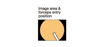 [image] Image area & forceps entry position