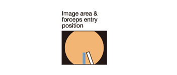 Image area & forceps entry position